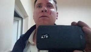 В Крыму "титушки" жестоко избили чиновника Евросоюза, возглавляющего проект ЕС по помощи в развитии автономии. ФОТОрепортаж