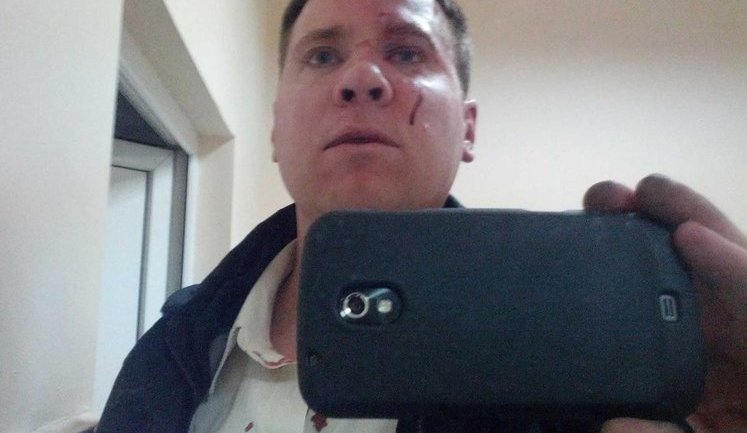 В Крыму "титушки" жестоко избили чиновника Евросоюза, возглавляющего проект ЕС по помощи в развитии автономии. ФОТОрепортаж