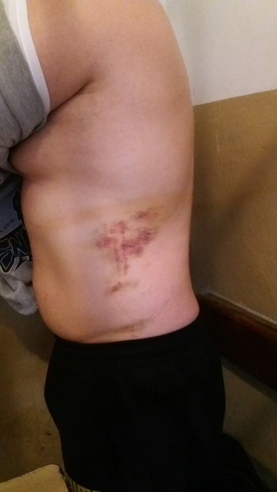 В Кропивницком СИЗО систематически издевались над двумя задержанными и угрожали заразить СПИДом и туберкулезом, - Денисова 01 В Кропивницком СИЗО систематически издевались над двумя задержанными и угрожали заразить СПИДом и туберкулезом, - Денисова 01