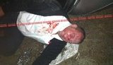 Opposition Candidate Had a Terrible Accident - Trucks with High Beams Suddenly Blocked the Road. PHOTOS