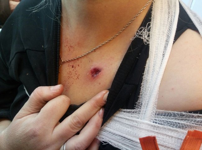 Invaders launch attacks on Ukrainian troops near Marinka 01