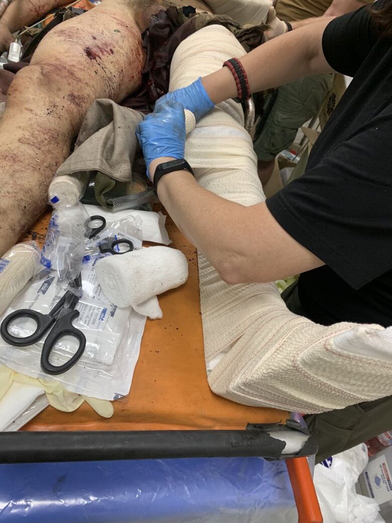 Російським полоненим допомагають, як нашим бійцям. Лише намагаєшся не думати, що це росіяни. Щоб не розстріляти чи не задушити, - парамедик Тетяна Скиртач, позивний Ромашка 05