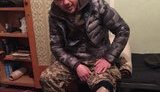 Обыкновенное чудо: доброволец Сергей Козак перенес 34 операции и вернулся служить