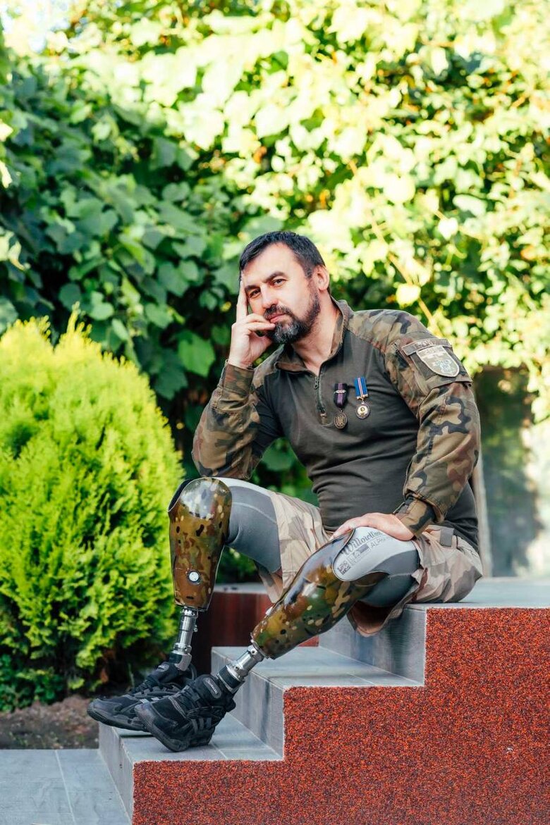 Військовослужбовець Артем Мороз: У мене влили два з половиною літри крові. Я не знаю, як я вижив 08 Військовослужбовець Артем Мороз: У мене влили два з половиною літри крові. Я не знаю, як я вижив 08