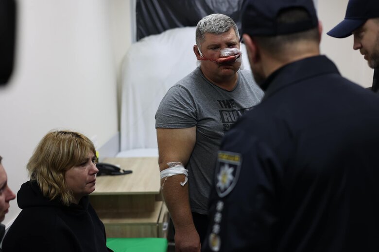 Кількість загиблих у результаті обстрілу окупантами цивільної колони у Запоріжжі зросла до 30, 88 людей поранені, - Нацполіція 07 Кількість загиблих у результаті обстрілу окупантами цивільної колони у Запоріжжі зросла до 30, 88 людей поранені, - Нацполіція 07