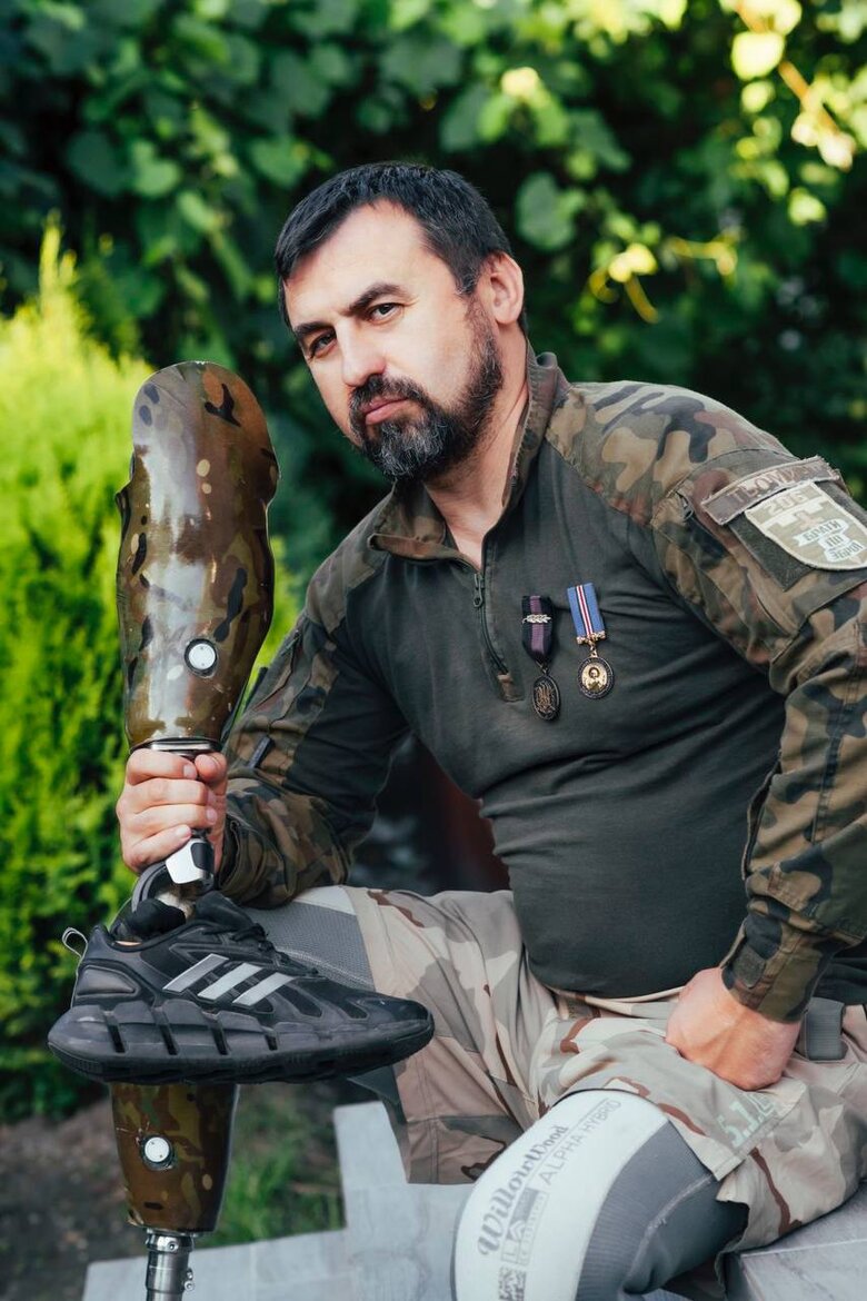 Військовослужбовець Артем Мороз: У мене влили два з половиною літри крові. Я не знаю, як я вижив 10 Військовослужбовець Артем Мороз: У мене влили два з половиною літри крові. Я не знаю, як я вижив 10