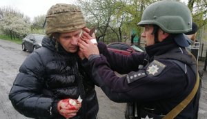 Five police officers were injured when grenade exploded during arrest of man in Dnipropetrovsk region. PHOTOS