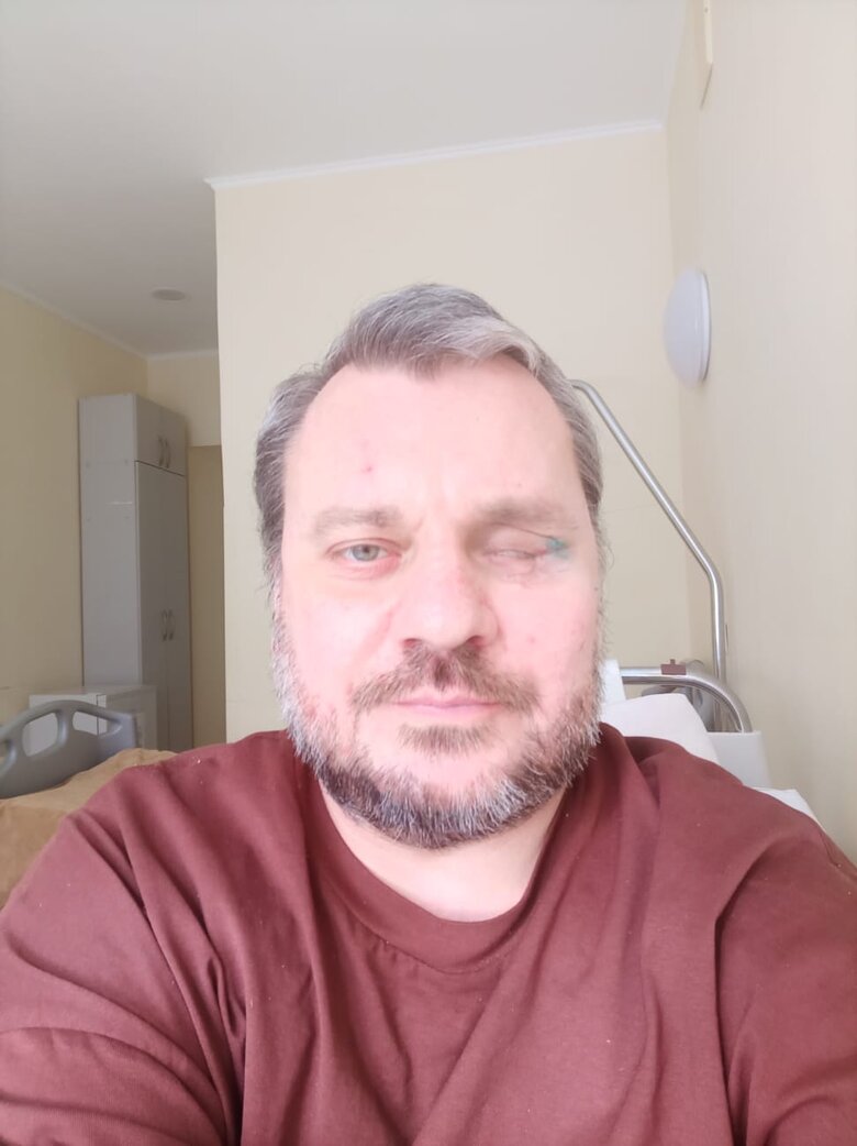 Командир прикордонної застави вогневої підтримки Андрій Соломонюк: Почав по танку з автомата стріляти, щоб перемкнути увагу на себе і дати хлопцям час вийти з будівлі. Дивлюсь – башточка повертається, далі нічого не пам’ятаю 03