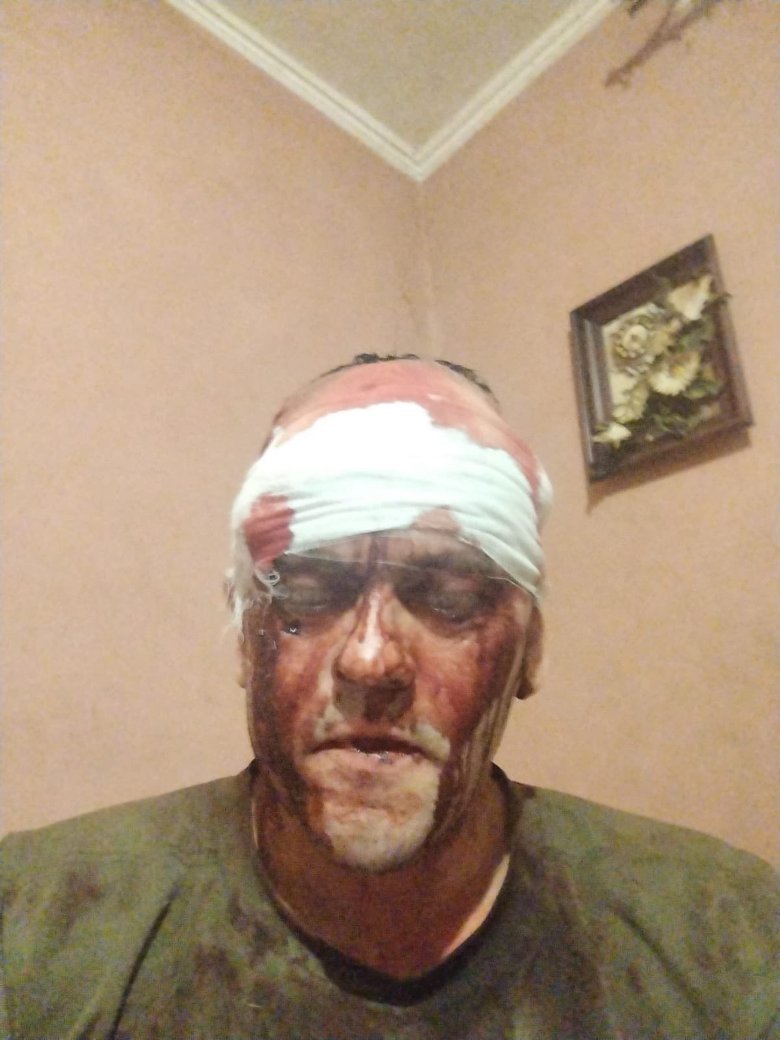 Побиття ветерана на Львівщині: реакція поліції на інцидент