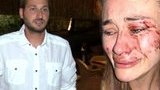 Власник турецького пляжу звинуватив побиту українську модель Кирилюк у наклепі