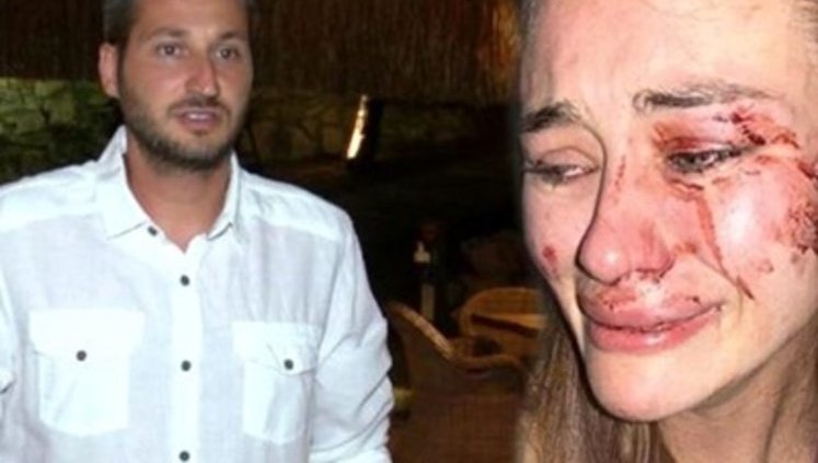 Хозяин турецкого пляжа обвинил избитую украинскую модель Кирилюк в клевете
