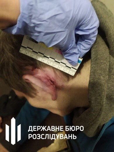 В Киевском СИЗО умер заключенный после избиения