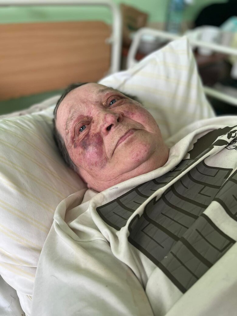 Рашисты в Херсоне сломали позвоночник 70-летней волонтерке из-за отказа отдать украинский паспорт 02