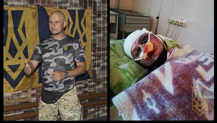 Activist got severely beaten in Dnipropetrovsk region: his fight against drug trafficking named as cause behind attack. PHOTOS