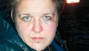 Невідомі побили місцеву активістку Петрик-Єльникову в Коцюбинському: повалили її на землю і били ногами, - Червакова. ФОТО