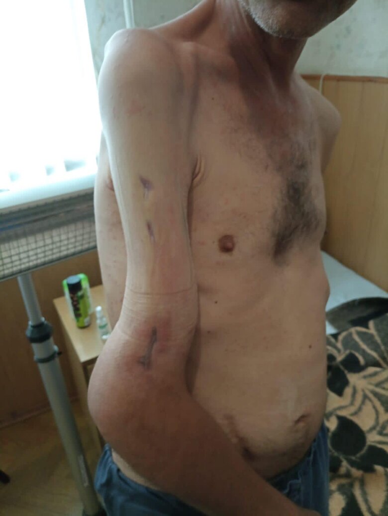 Морський піхотинець Михайло Діанов, позивний Мішаня: Азовсталь - то був жах. Рани мої гнили. Апарат з’їхав, кістки не тримав. Ми вже були в кільці, їли гнилі продукти 06