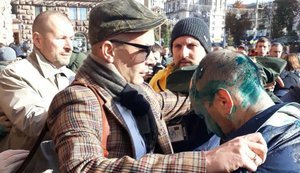 Поліція відпрацьовує три версії про напад на Гусовського, - Крищенко