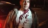 Российские власти начали зачистки: депутата-оппозиционера обстреляли по пути на "Марш миллионов". ФОТОрепортаж