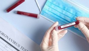 Минздрав спрогнозировал пик заболеваемости коронавирусом к концу октября