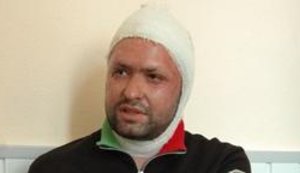 "Кислотное дело" Чижмаря: преступник выслеживал жертву полгода. Чиновник даже к нему привык. ФОТО