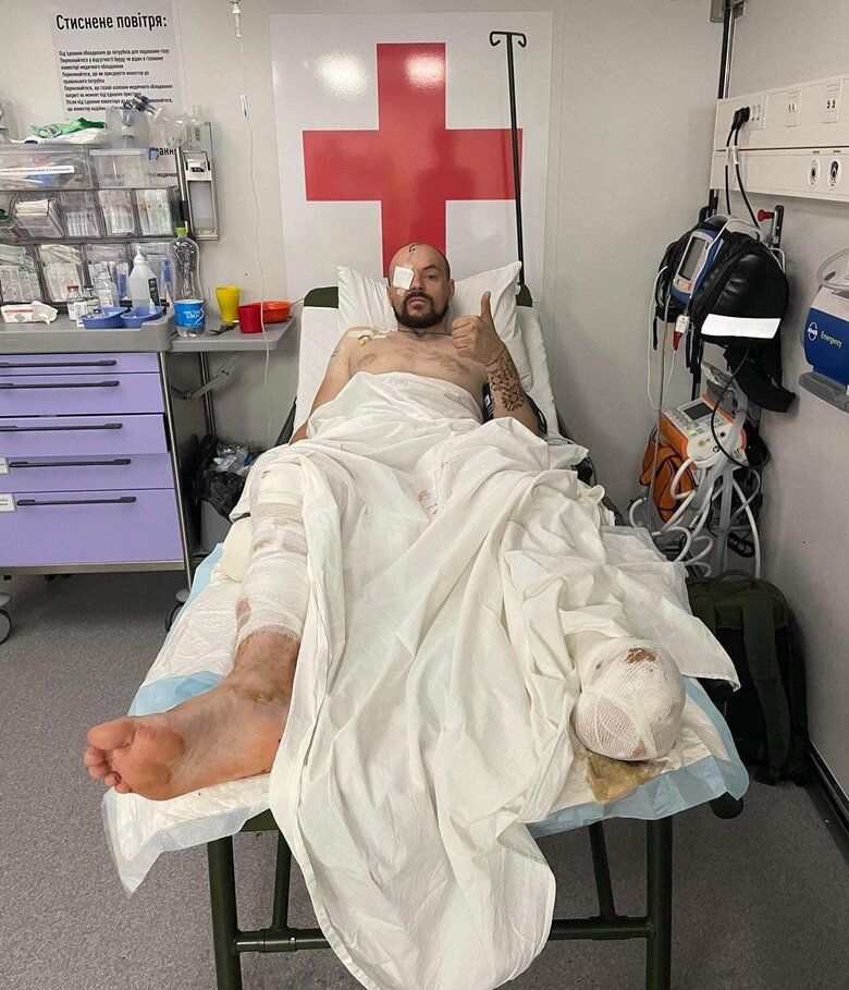 Микола Русецький, позивний Молот: Хочу власним прикладом показувати, що без руки чи ноги все одно можна жити і працювати на захист України 03