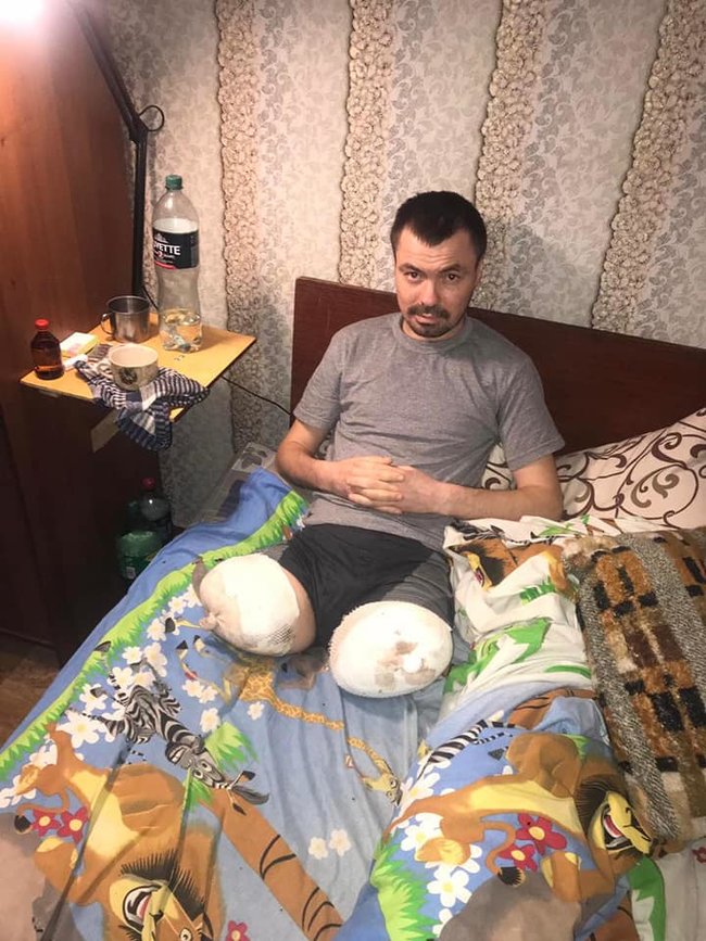 Український воїн Олександр Головатий унаслідок нещасного випадку на вокзалі в Києві втратив ноги: йому необхідна допомога, - підполковник ЗСУ Баранов 04