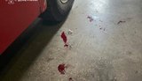 Оккупанты атаковали пожарно-спасательную часть в Краматорске: ранены четверо пожарных. ФОТОрепортаж