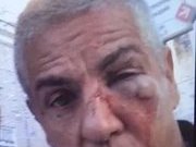 Сами Насери рассказал о драке в московском караоке-клубе