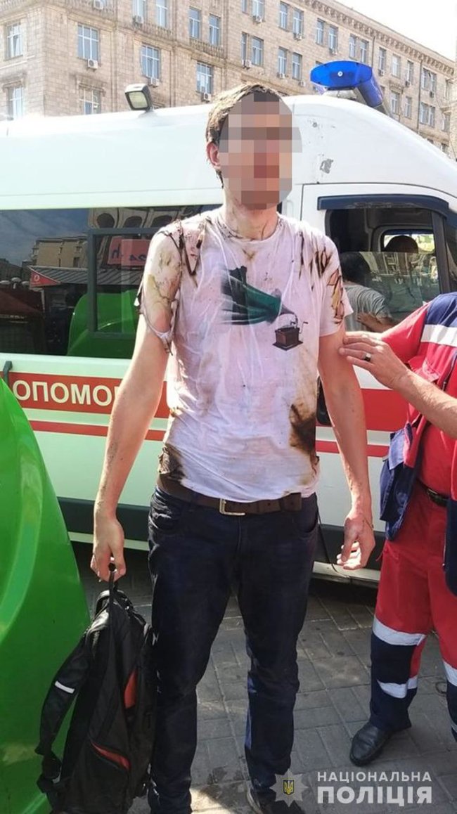 Чоловік підпалив себе в центрі Києва, - МВС 01