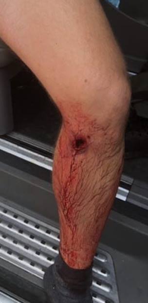 Рейдерське захоплення фермерського господарства на Харківщині - поранено 7 осіб, затримано одного з тітушок, банду блоковано 03 Рейдерське захоплення фермерського господарства на Харківщині - поранено 7 осіб, затримано одного з тітушок, банду блоковано 03