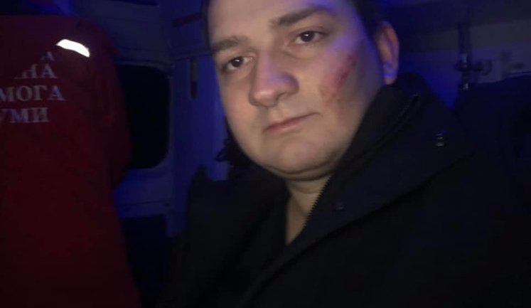 Двоє невідомих у балаклавах напали на нардепа від "Слуги народу" Ананченка в Сумах. ФОТО (оновлено)