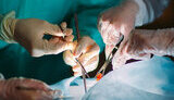 Ukraine bans transplantation of organs of fallen soldiers