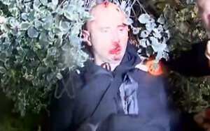 Security forces in Georgia beat journalists during protests