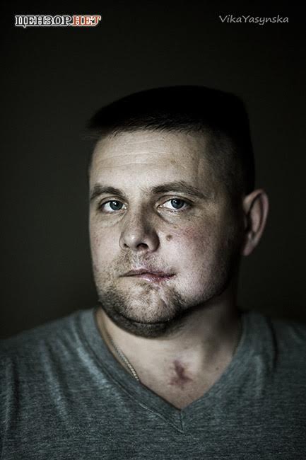 Я попрощався з життям. Коли прийшов лікар, я спитав у нього, чи я вже на тому світі? - важкопоранений боєць 80 бригади Андрій Усач 01