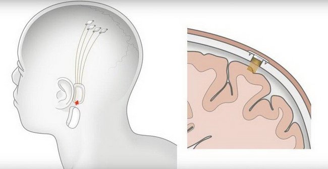 Цензор.НЕТ Изображение