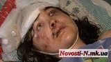 Новые подробности "милицейского" изнасилования: "Добивали молотком по голове. Ползла и молила Бога, что бы только дотянуться до помощи". ФОТОрепортаж
