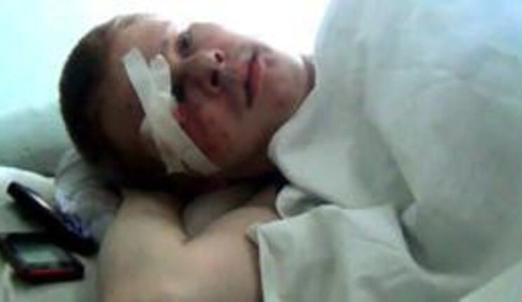 Жестоко избитый руководитель "Дорожного Контроля" не может передвигаться: "Его заказали". ФОТО+ВИДЕО