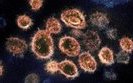 Американські вчені виявили антитіло, яке здатне нейтралізувати COVID-19, - дослідження