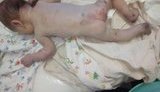Під лікарню в Первомайську підкинули побитого новонародженого. У малюка численні синці та садна, а також ЗЧМТ. ФОТОрепортаж