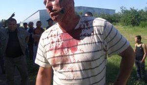 Кровавая жатва на полях Корнацкого: "Это пиз##ц какой-то. Пацаны все белоцерковские приехали, кароче", - журналисты разыскали нападавших. ВИДЕО