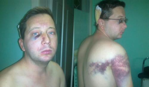 евромайдан лечение