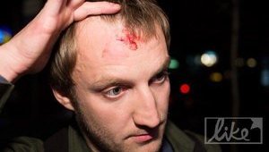 Милиция возбудила дело против охранника Киркорова, который разбил голову журналисту. ФОТОрепортаж