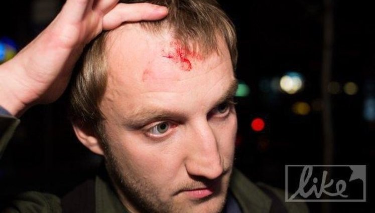 Милиция возбудила дело против охранника Киркорова, который разбил голову журналисту. ФОТОрепортаж