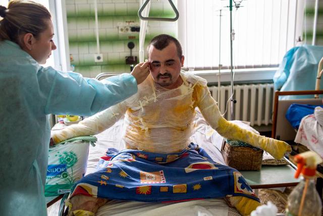 ato wounded