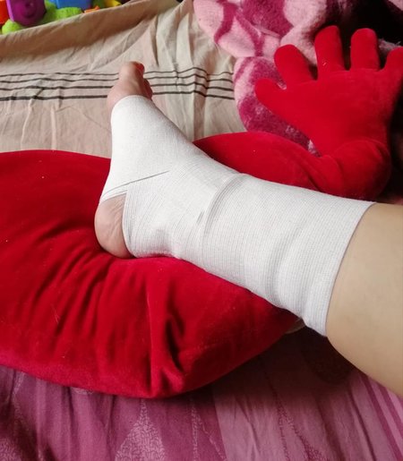 Неизвестные избили сторонницу Руха нових сил Олишевскую: у нее сотрясение мозга, трещина в кости, многочисленные ушибы 01