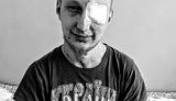 Тяжкопораненому українському воїну Віталію Велісевичу потрібна допомога. ФОТО