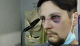 На двох ветеранів у Львові напали поліцейські з Чернівців, Ковеля і Бережан. ФОТО