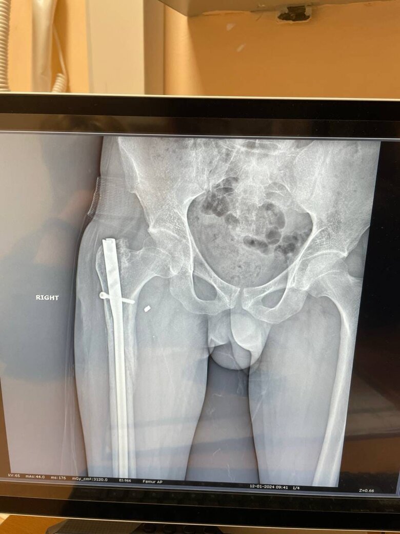 Військовий третьої штурмової бригади Алік