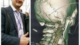 Поліція почала службове розслідування за фактом конфлікту правоохоронців і активіста "Громадянської позиції" у Вінниці. У постраждалого діагностували перелом черепа. ФОТО