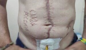 Russians branded words "Glory to Russia" into body of captured Ukrainian soldier. PHOTO OF THE DAY